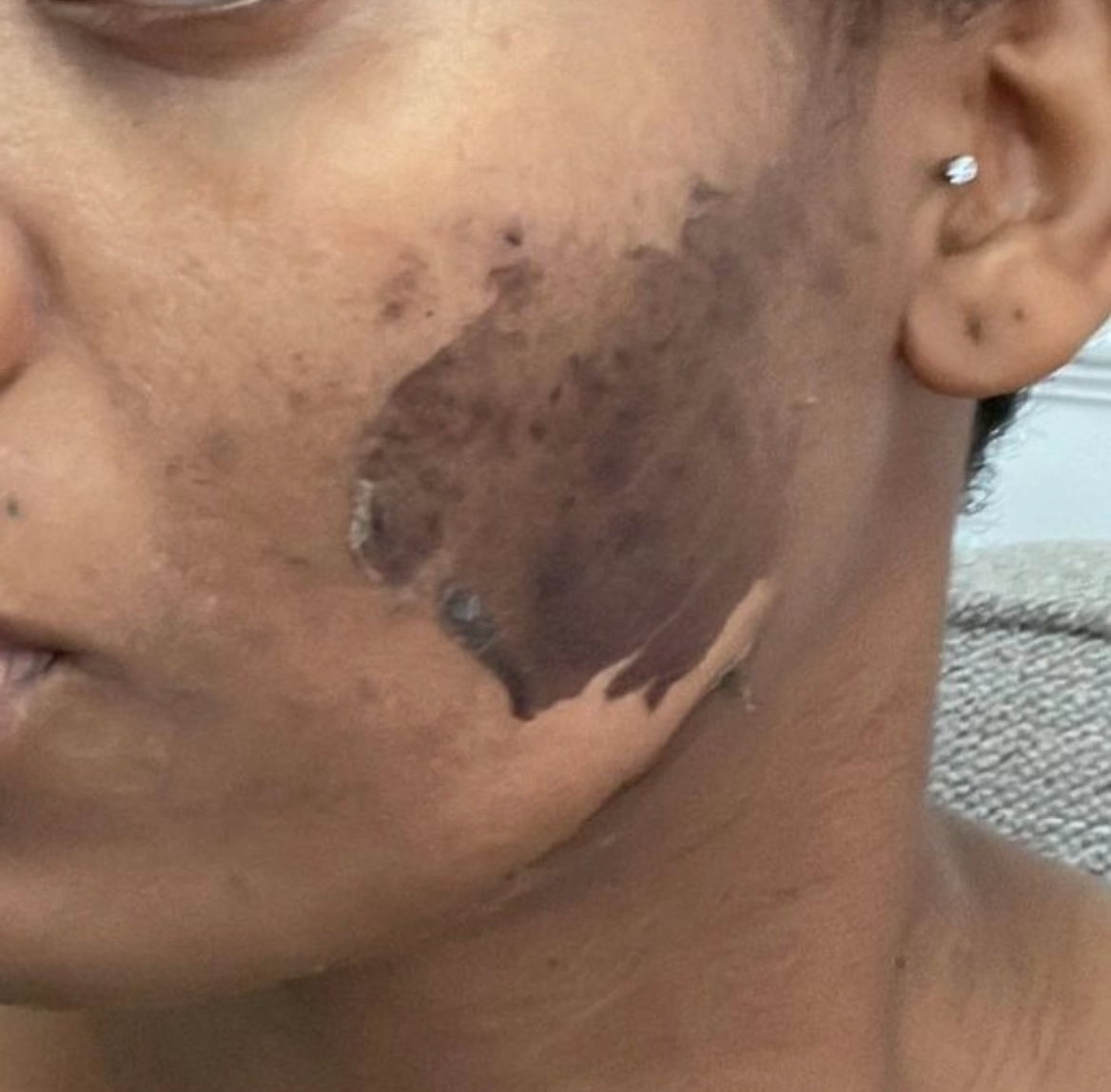 Facial repair kit